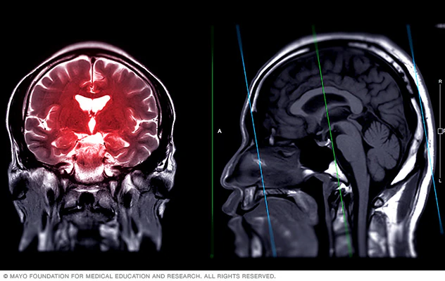 Neurology Billing
