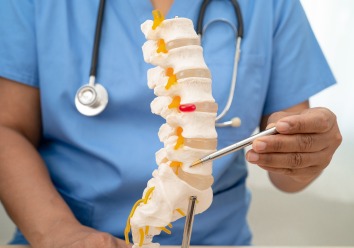 Ankylosing Spondylitis Billing