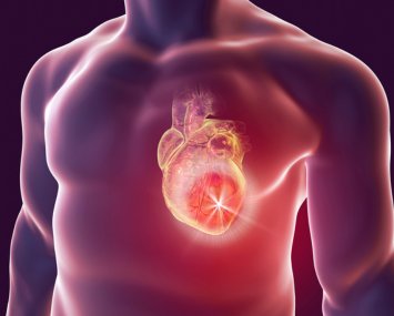 Cardiovascular Infectious Diseases