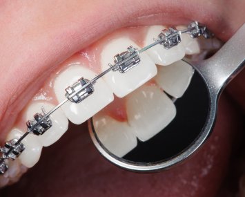Orthodontics
