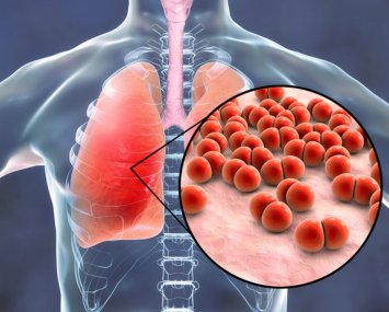 Respiratory Infections