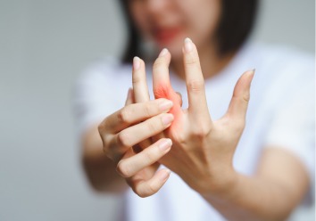 Rheumatoid Arthritis Billing