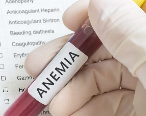 Anemia Care Billing